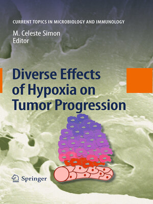 cover image of Diverse Effects of Hypoxia on Tumor Progression